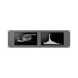 Blackmagic Design SmartScope Duo 4K 2 8-Inch SDI/HD-SDI/3G-SDI Video Monitor